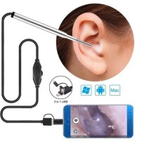 USB Otoscope Camera 3.9mm For Ear and Nasal Examination